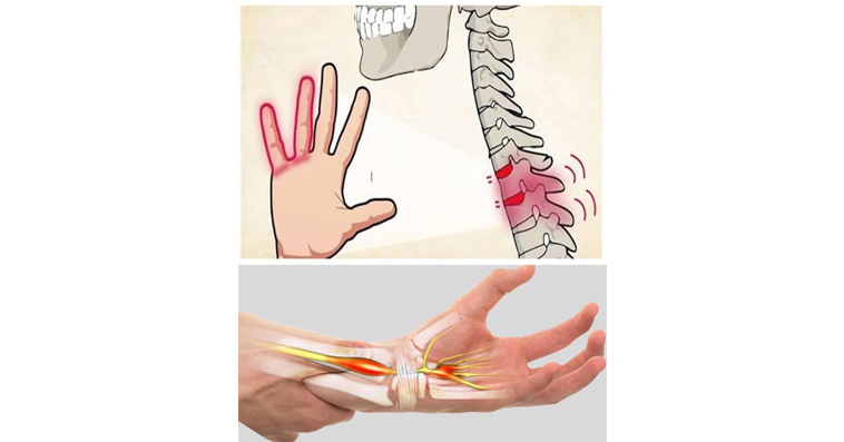 Numb Hand Is It Normal