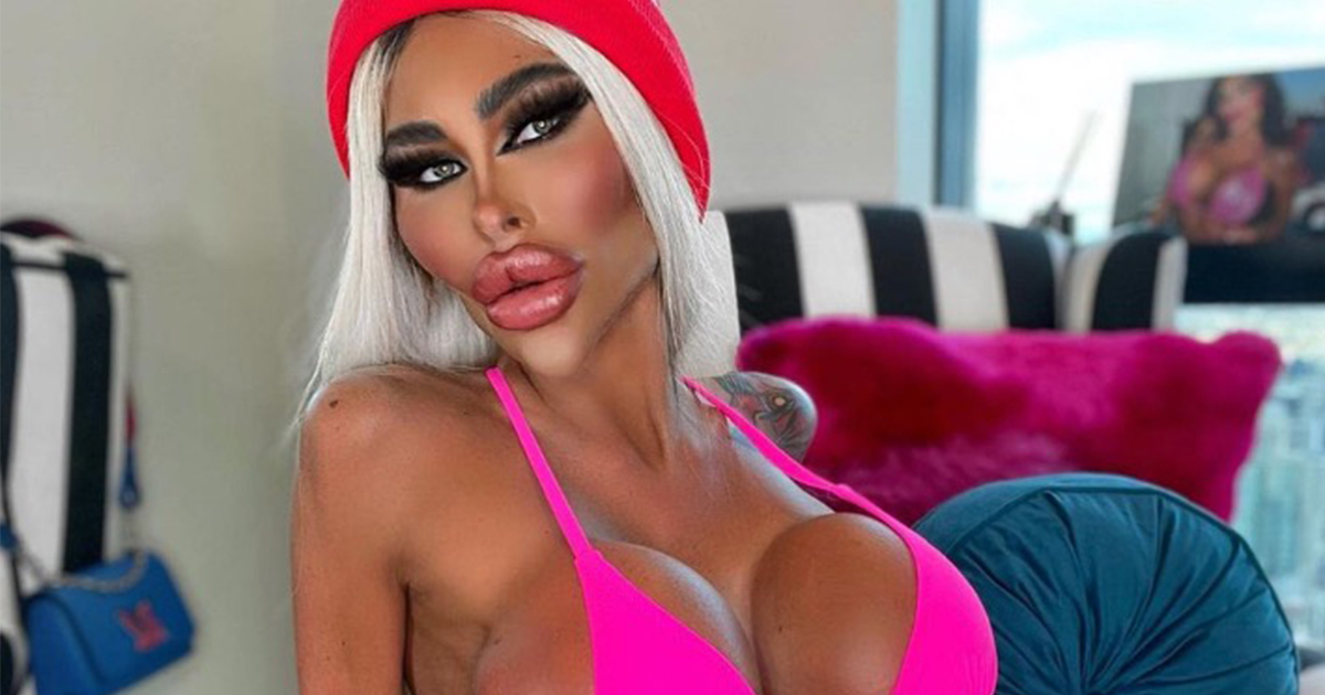 Plastic surgery addict spends $200K on plastic surgery
