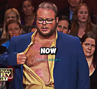 Man Sues Woman $80,000 After RIPPING His Skin