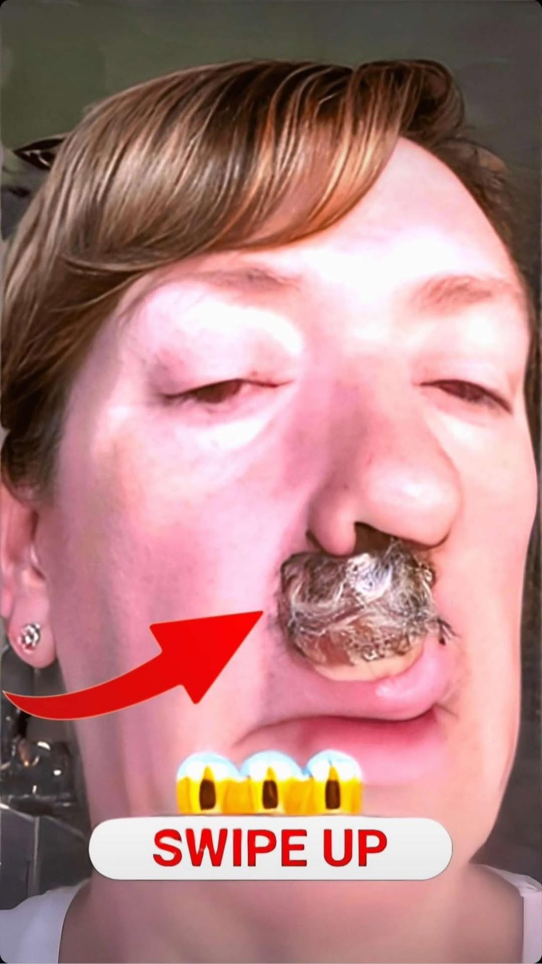 10 Inspiring Images That Prove Acne Is Not Ugly