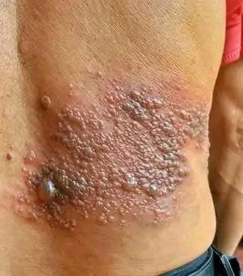 It was itching his body, he thought it was an allergy, but a tough diagnosis… See more