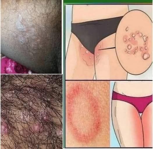 All The Symptoms Of Stomach Cancer