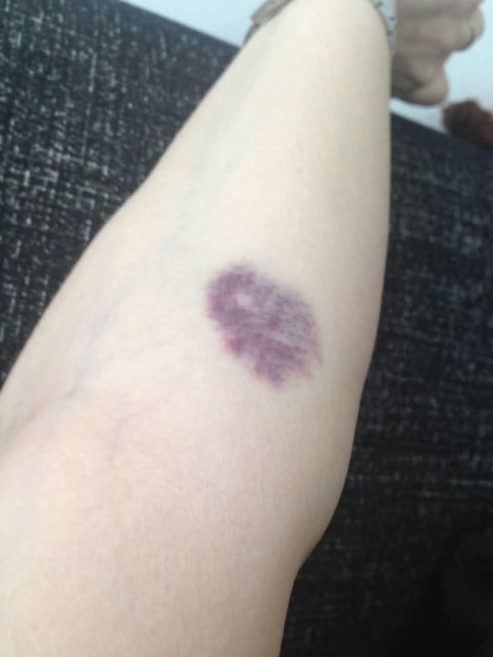 Understanding and Managing Those Painful Red Bumps