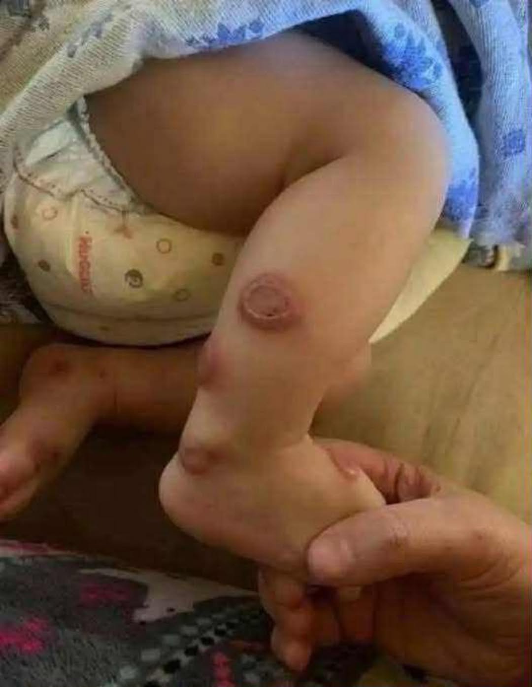 ALERT: These are the signs that it is cre…See more