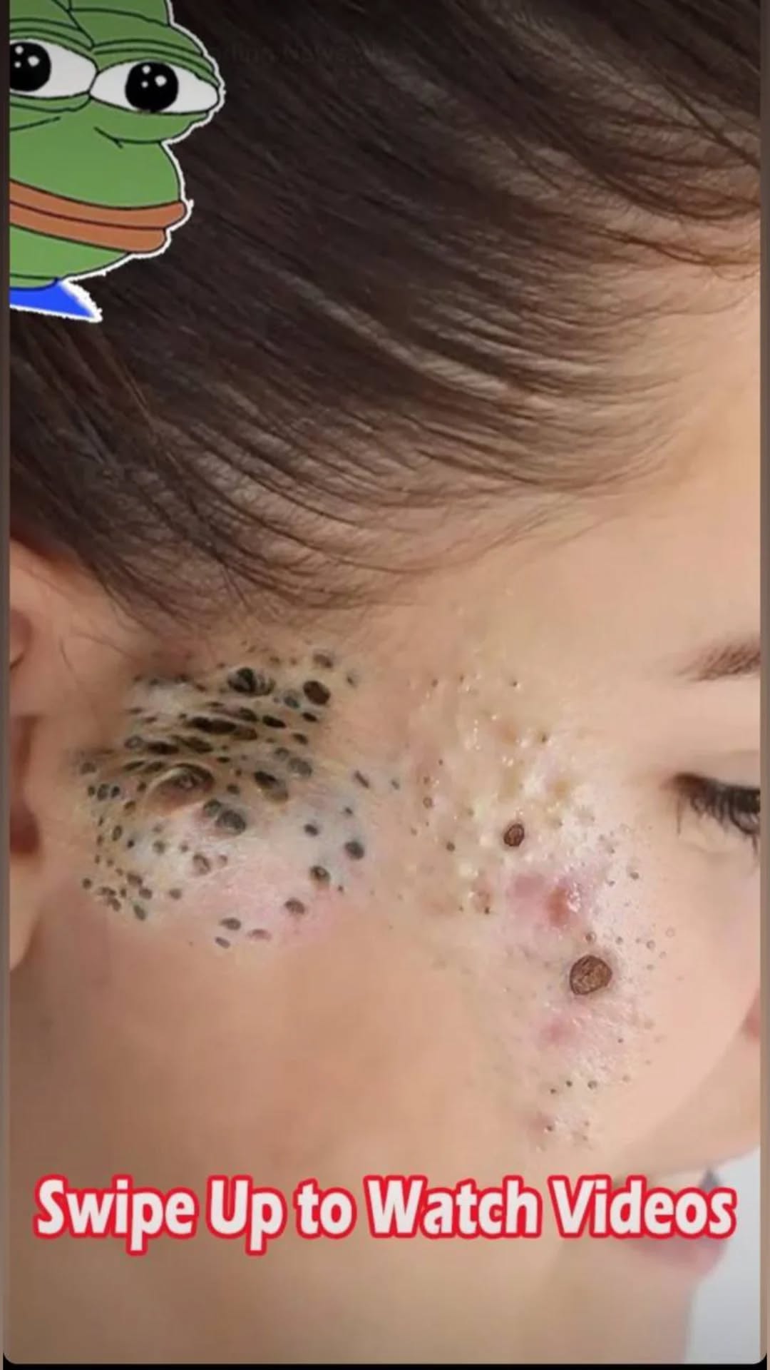 Understanding Deductibles and Co-Pays in Health Insurance