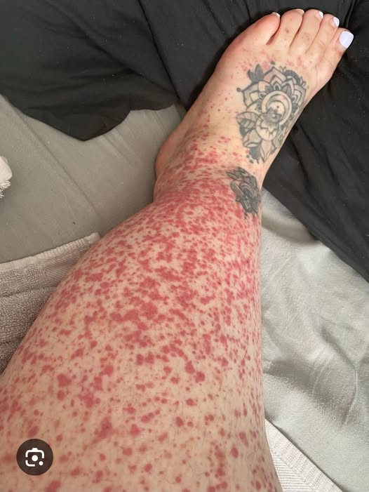 These are the consequences of sleeping withhhh…See more