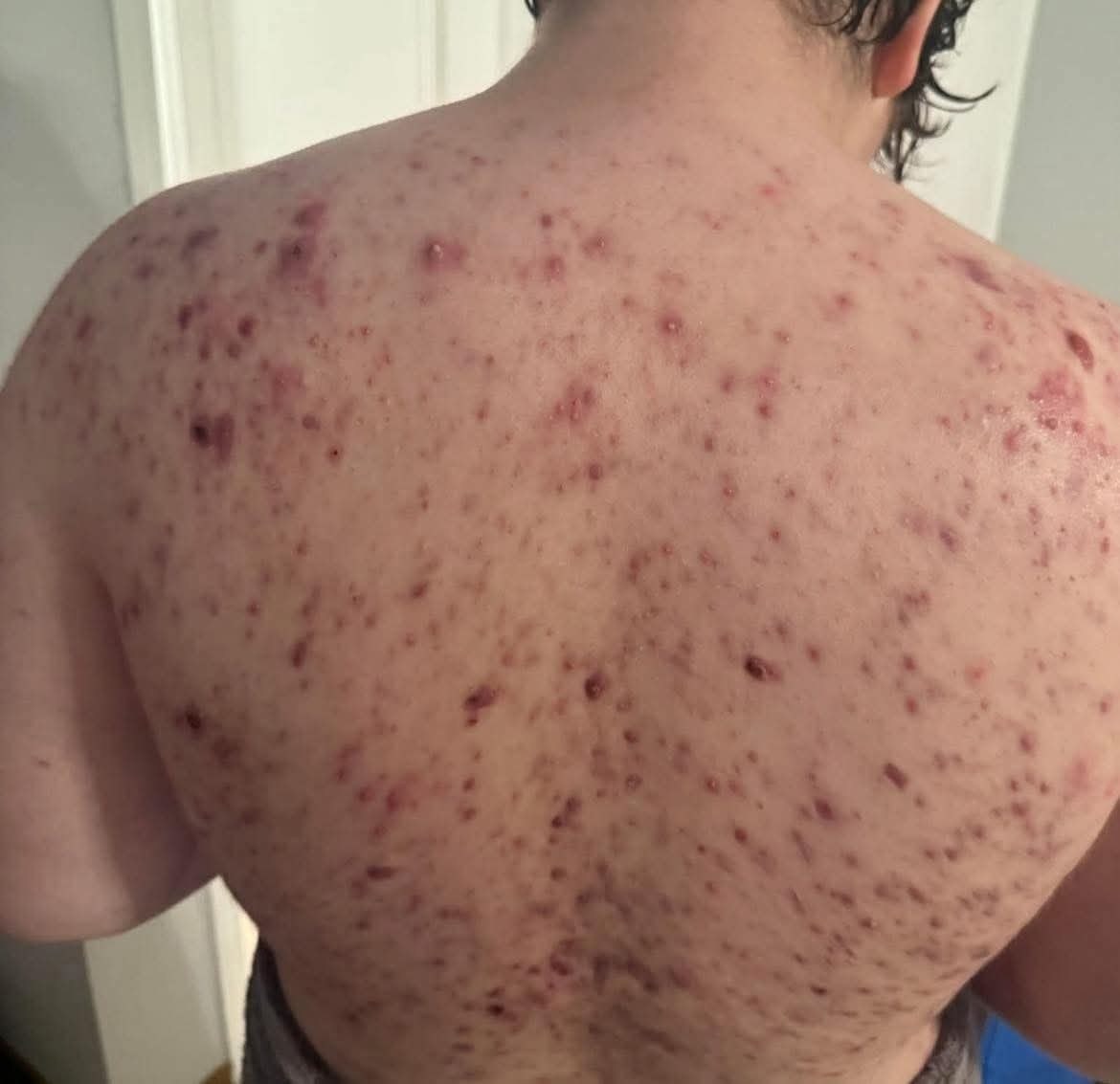 These are the consequences of sleeping with the…See moreeeeee