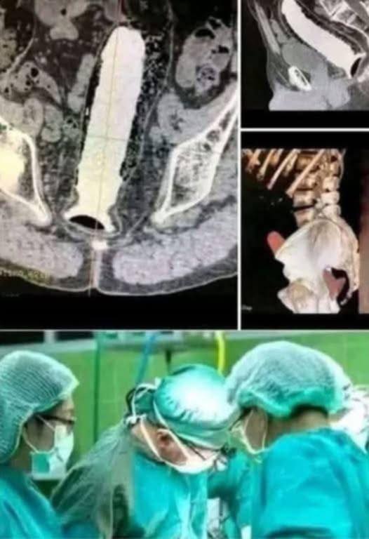 Girl had to be hospitalized for wanting to use a pe…See more