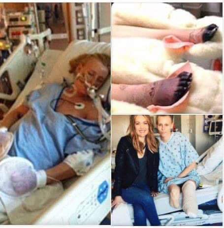 P3. Her legs are amputated after using a common household product – Now she’s warning women everywhere