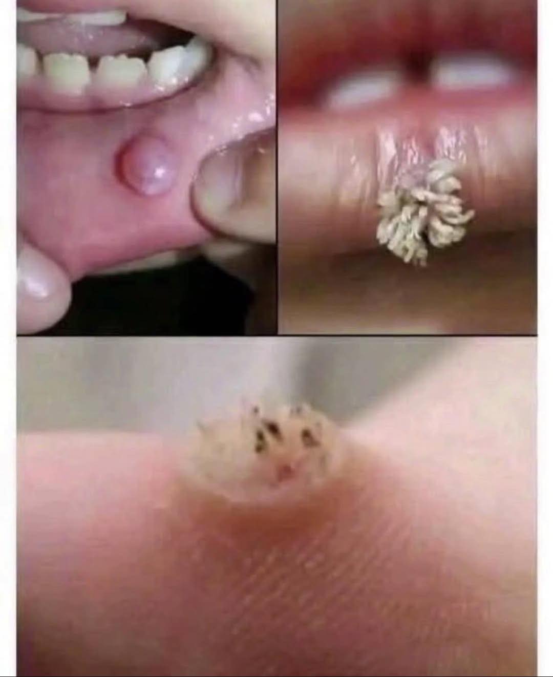 To BE VERY CAREFUL . If you get this, you are infected with …. Check the 1st comment