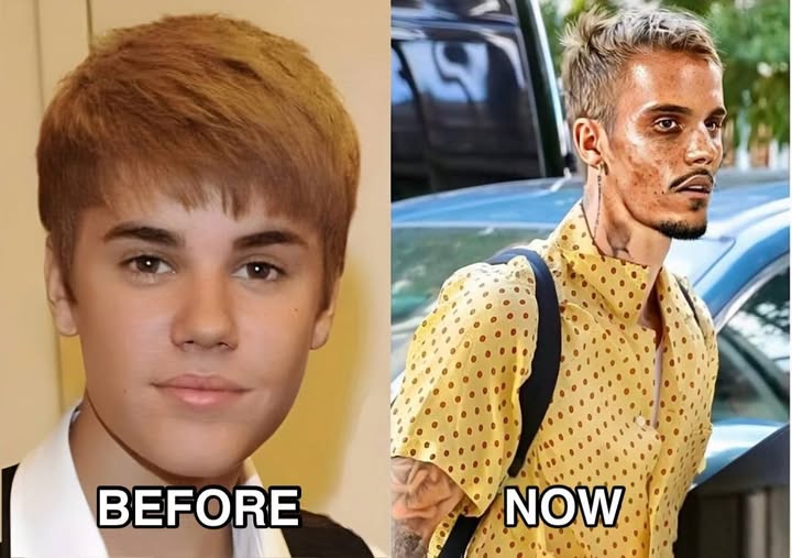 Justin Bieber admits that he tested positive for…