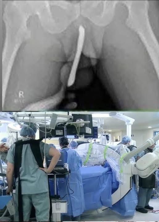 Girl was hospitalized