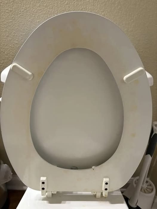 How I Got Rid of a Yellow Toilet Ring Without Replacing the Seat