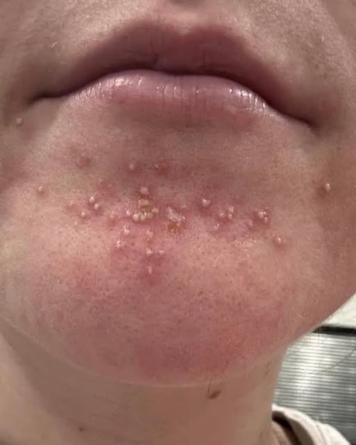 These are the consequences of sleeping with the…See more