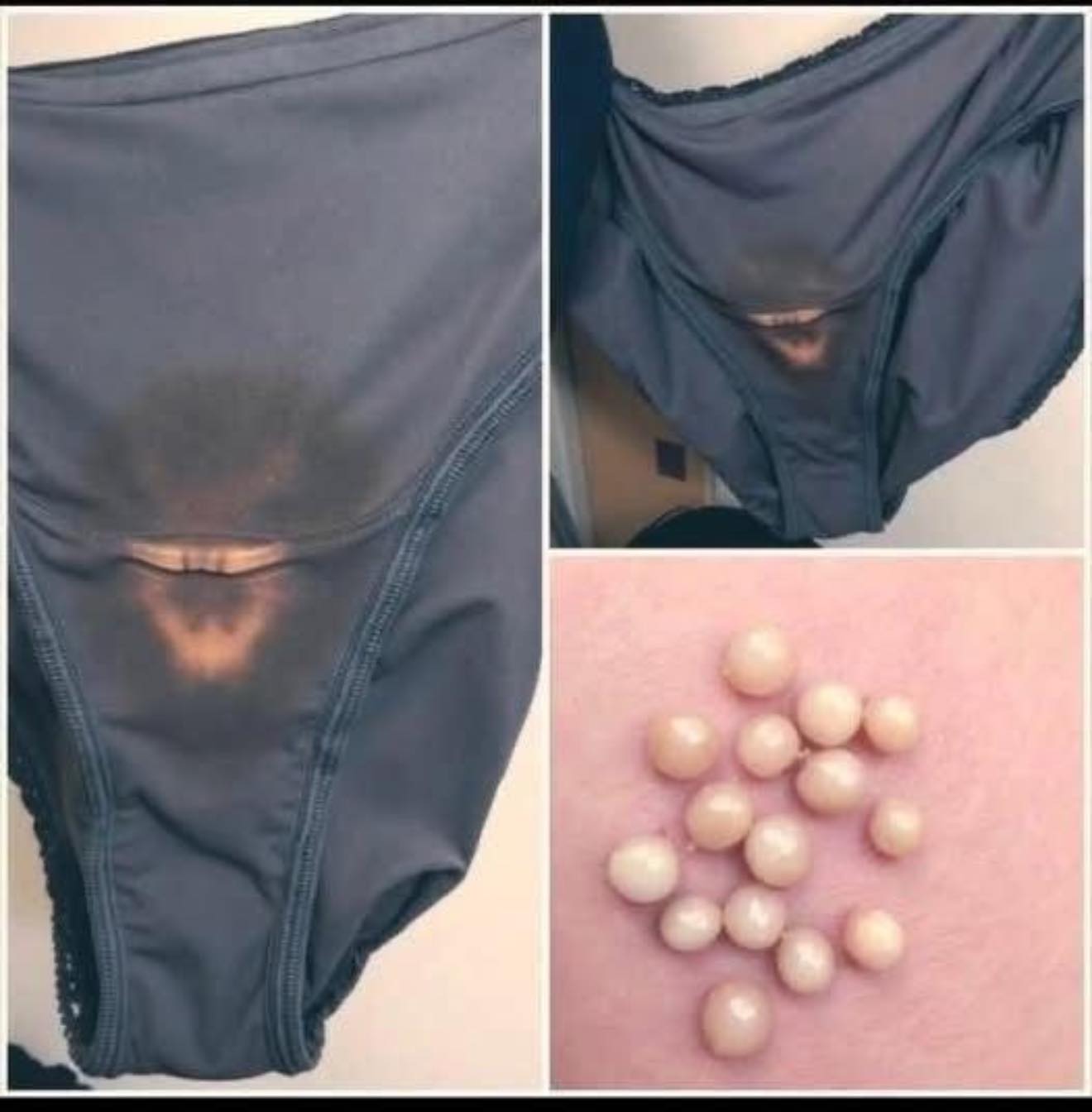 BE CAREFUL, if you notice this in your underwear, it means you have!!