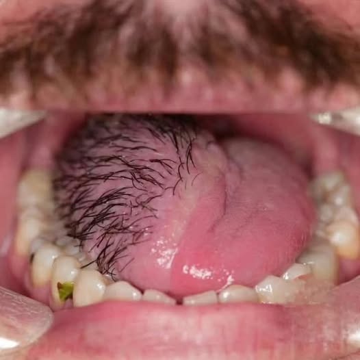 HT15. These Are The Consequences Of Eating Cr… See More
