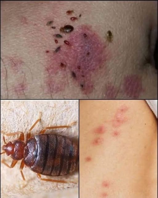 Natural Pest Control: Eliminate Bed Bugs and Household Pests with