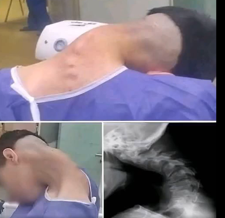 Young man hospitalized because he dropped his ca… See more