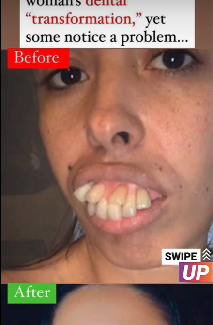 Millions of people see a woman’s dental “transformation,” yet some notice a problem…