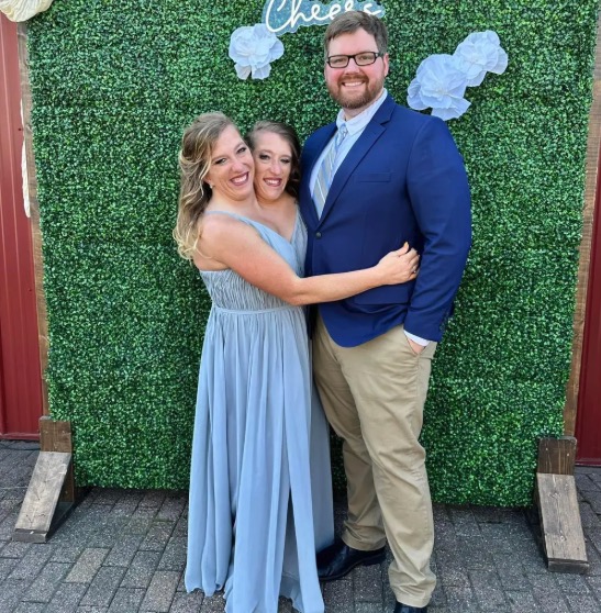 Mom of conjoined twins answers question everyone is asking