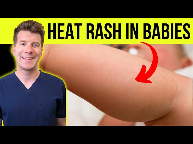 Essential Guide to Keeping Your Baby Comfortable and Rash-Free in Warm Weather