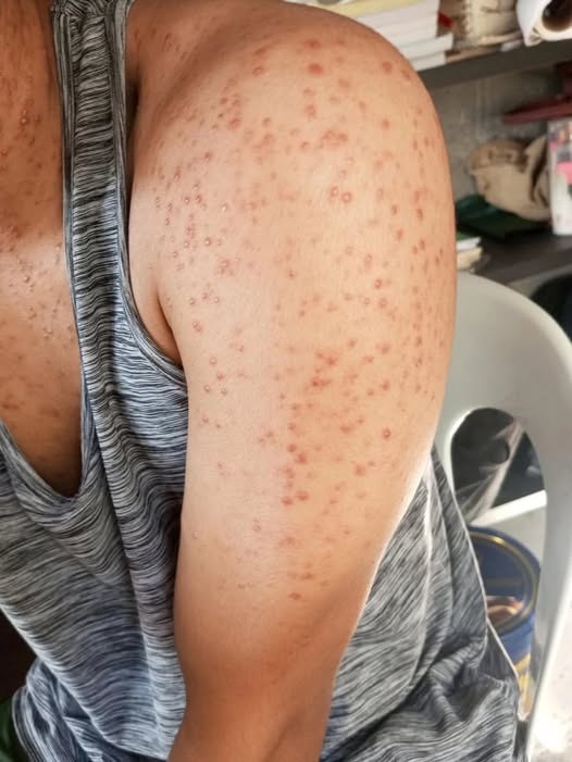 Sleeping with the wrong…