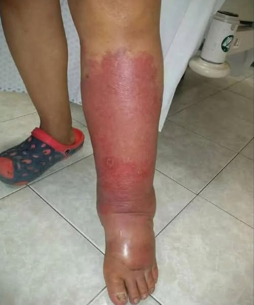 What Your Feet Might Reveal About Your Health Your feet can offer important clues about your overall well-being—here’s what to look for.