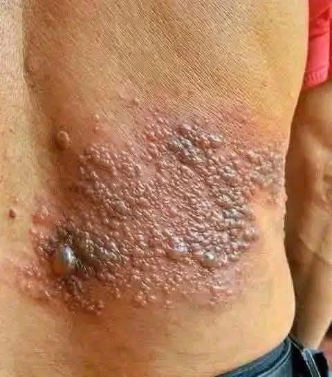 “These Are the Effects of Sleeping Without Removing Makeup — What You Need to Know”